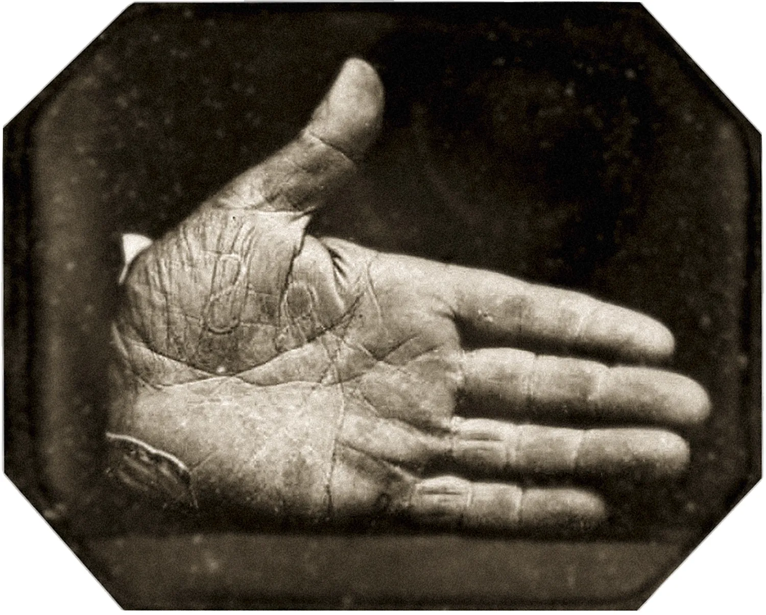 Johanthan Walker’s right hand with “SS” branded onto the palm. 