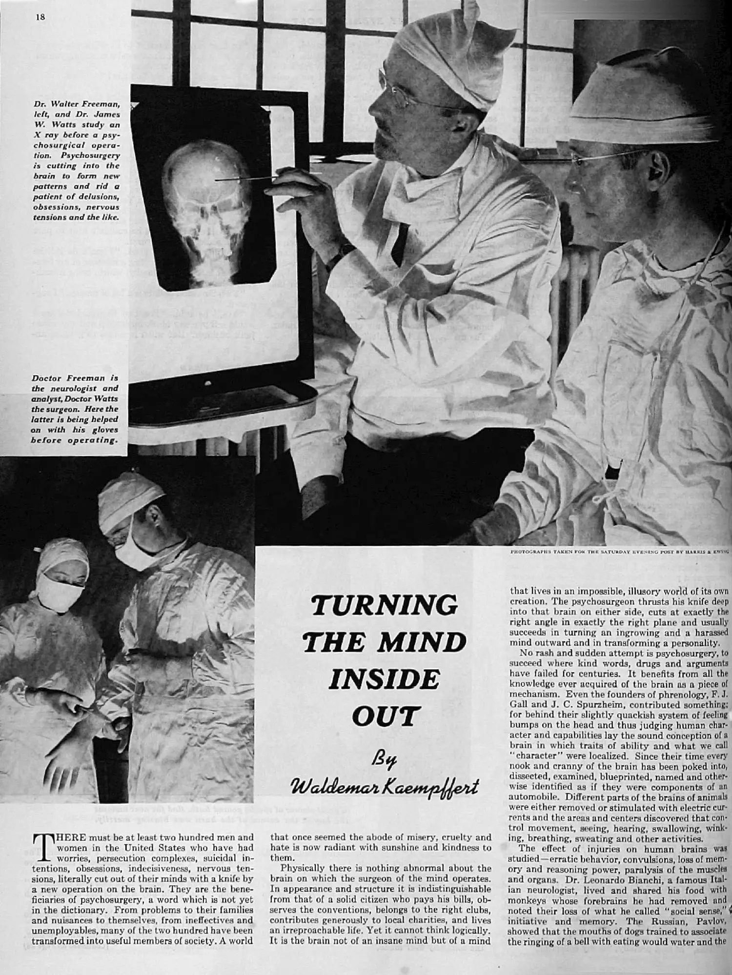 Scan of an article. One image shows surgeons in lab coats looking at an x-ray of a skull and another shows a masked nurse helping a masked surgeon put on gloves before surgery. The text of the article is about “psychosurgery.”