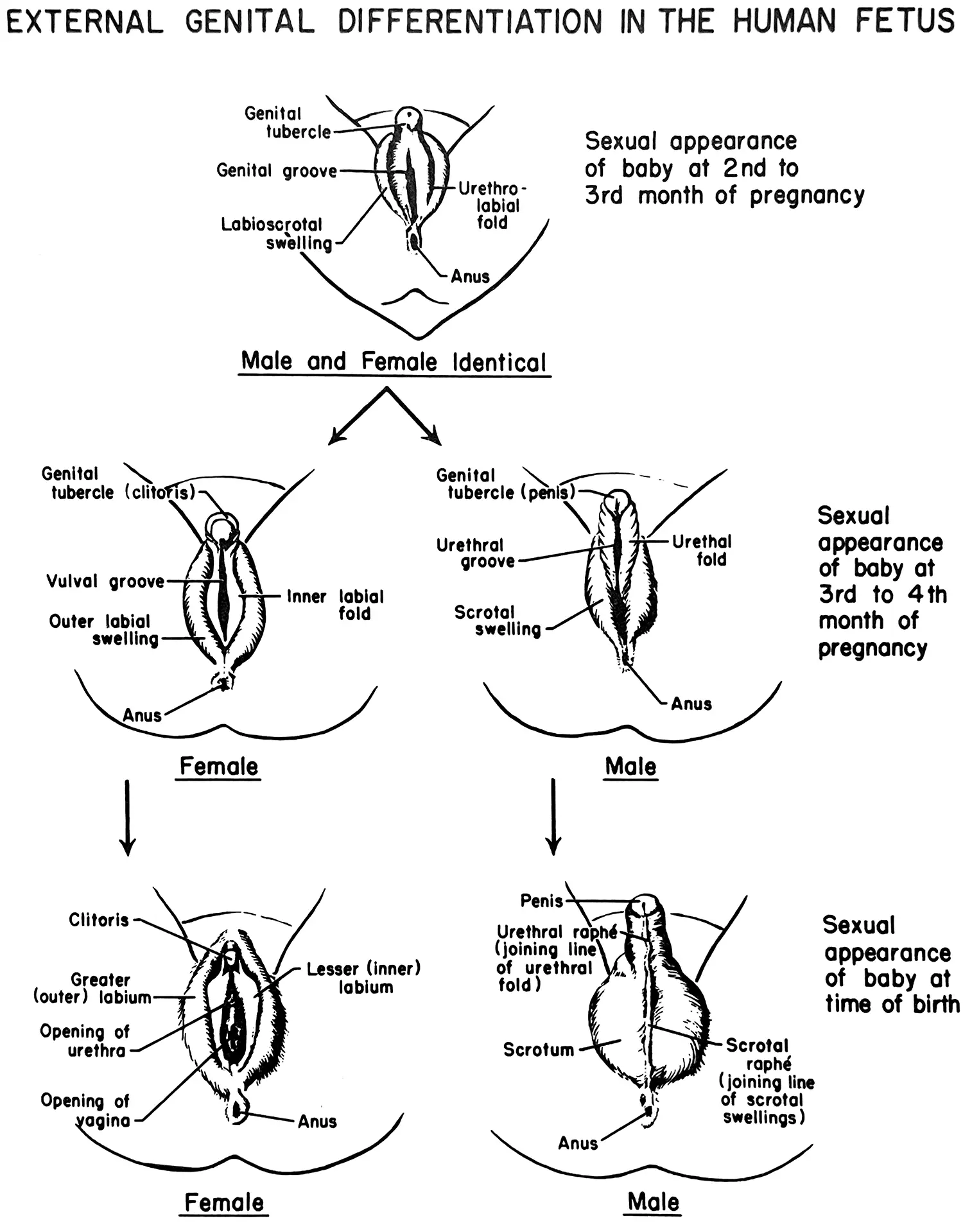A detailed medical diagram shows three stages of differentiation of a baby’s external genital organs. It shows how there is a common sexual appearance of the baby at the second to third month of pregnancy which then starts to differentiate (between a vulval groove and urethral groove) at the third to fourth month of pregnancy to finally the fully formed external genital organs at the time of birth. 