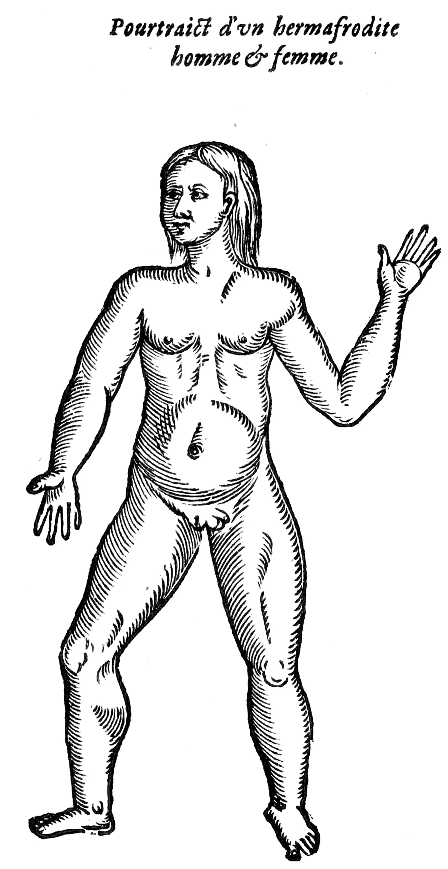 A illustration titled “Pourtraict d’un hermafrodite homme & femme.” It depicts a person standing with their arm raised, displaying anatomical features which could be either male or female.