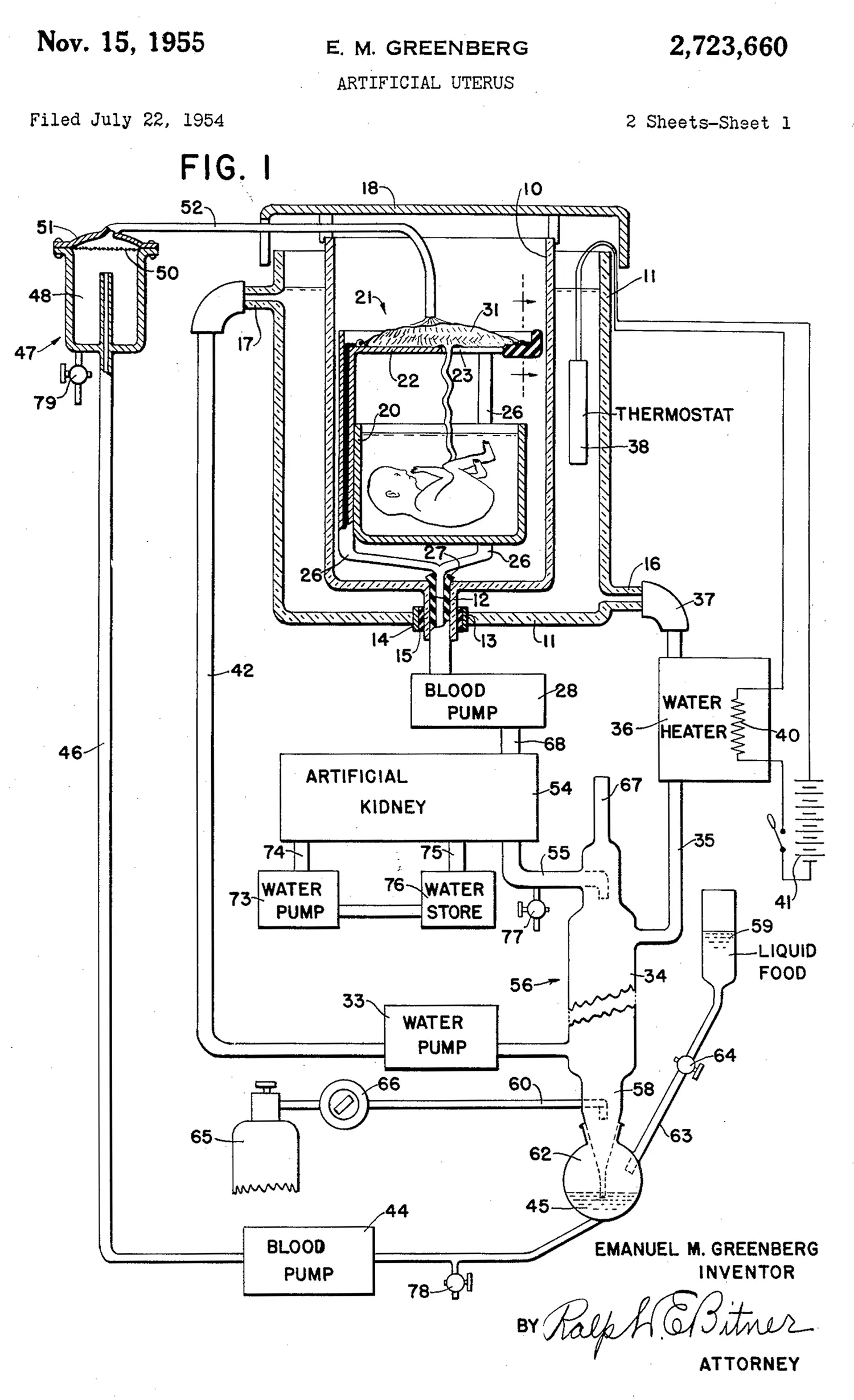 A patent diagram showing a fetus suspended in a vat connected to a series of labeled devices such as “thermostat,” “blood pump,” “water heater,” “artificial kidney,” “liquid food,” etc.