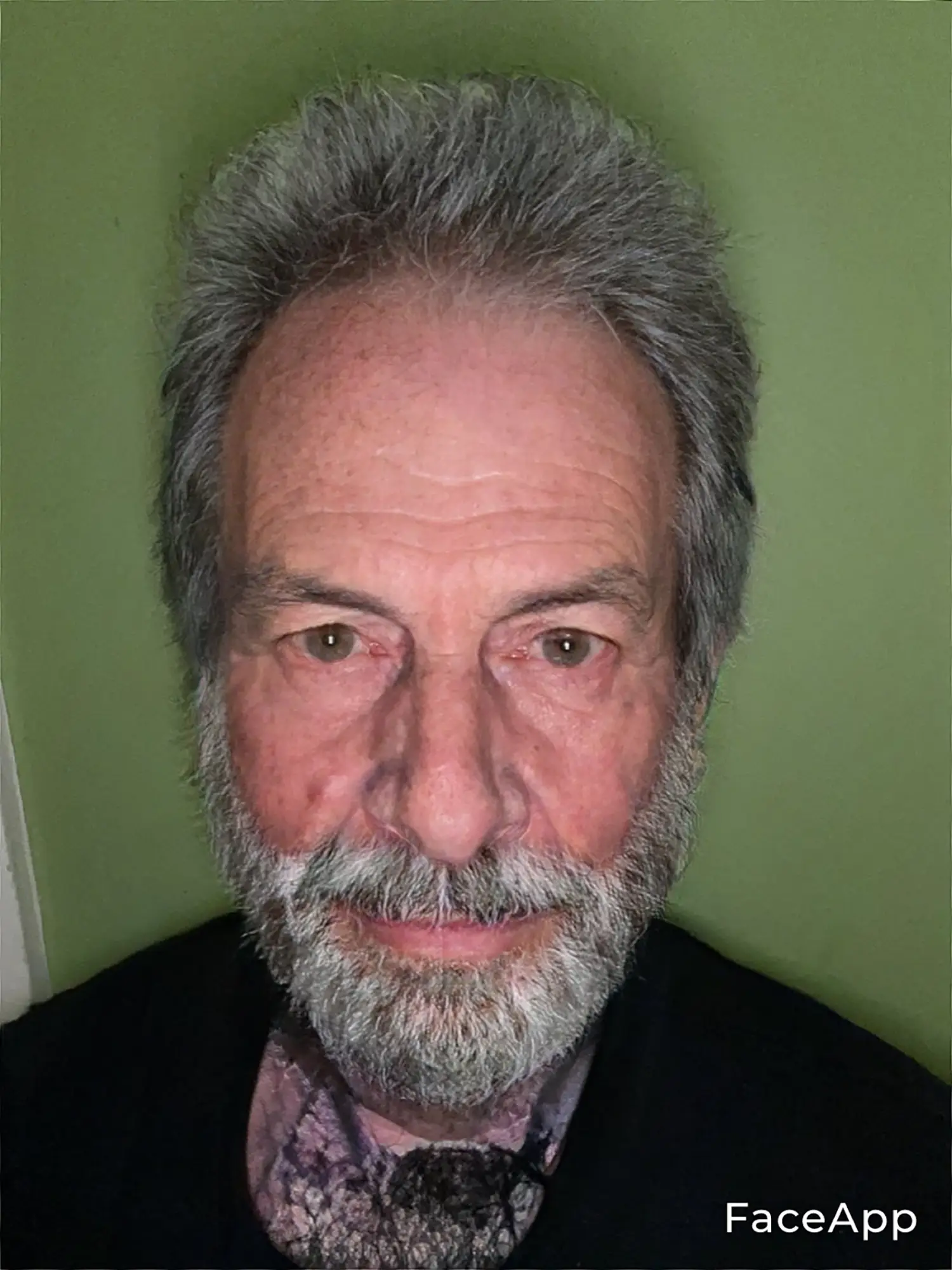 The author’s face transformed by filters to appear young, wearing lipstick, puffy, and old.
